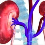 बदलती जीवनशैली और अनियमित खान-पान से बढ़ रहा किडनी रोग का खतरा, डॉक्टरों ने दी चेतावनी